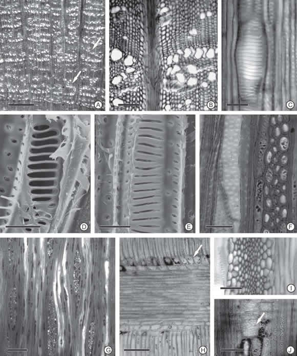 pictures of xylem. Secondary xylem cells from